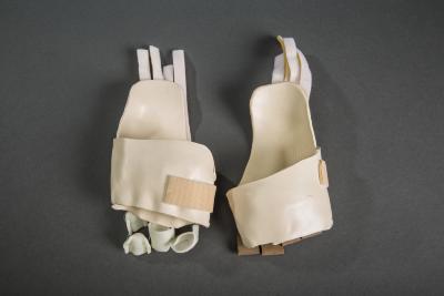 Burn Casts 